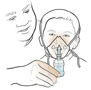 Man holding nebulizer canister and mask on child's face.