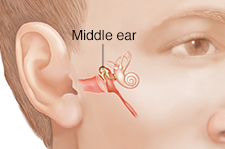 Man's face showing middle ear structures.