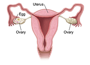 Outline of female pelvis showing uterus and ovaries.