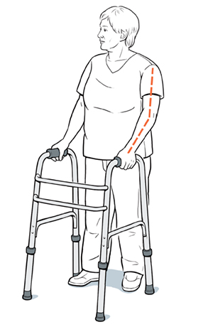 Three-quarter view of woman using walker. Dotted line shows woman's elbow slightly bent when she holds on to walker handles.