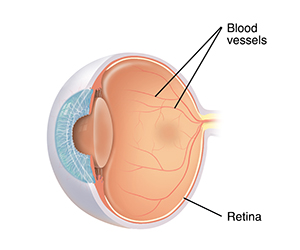 Cross section three-quarter view of eye showing normal blood vessels on retina.