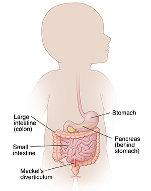 Outline of infant showing digestive system and location of Meckel's diverticulum.