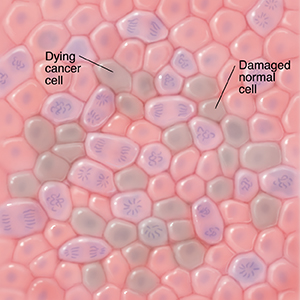 Microscopic view of normal cells, damaged cells, cancer cells, and dying cancer cells.
