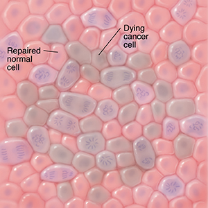 Microscopic view of normal cells, repaired cells, and dying cancer cells.