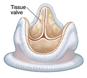 Biological heart valve.