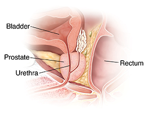 Cross section of prostate gland.