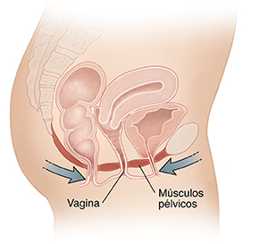 Vista lateral de un corte transversal de un abdomen y una pelvis femeninos donde se ven los músculos del suelo pélvico. Las flechas muestran los músculos contrayéndose para los ejercicios de Kegel.